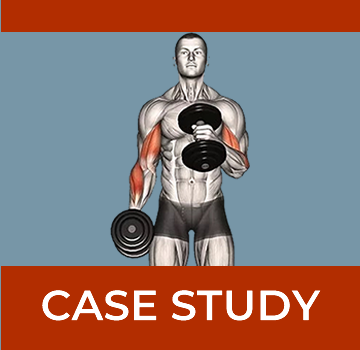 Inflamed Superficial Branch of the Radial Nerve - WristWidget® 